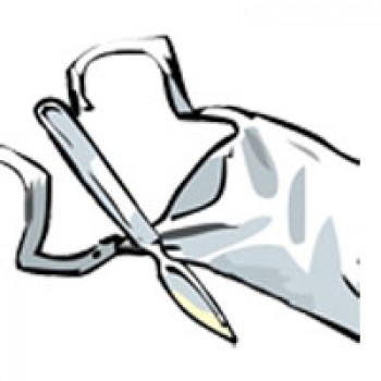 Хирургия общая и частная Хирургия общая и частная