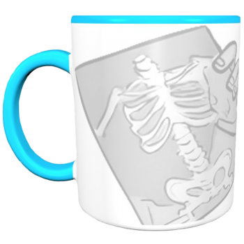 Кружка «Рентгенолог — сдержанный стиль»